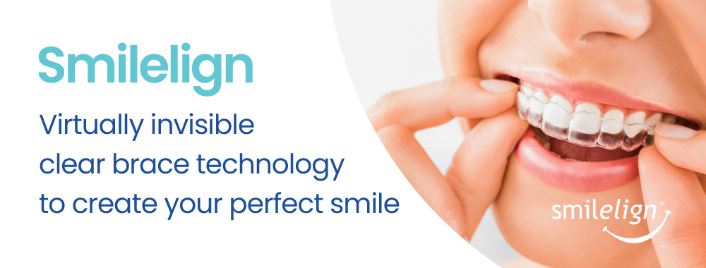 Smilelign - Virtually invisible clear brace technology to create your perfect smile